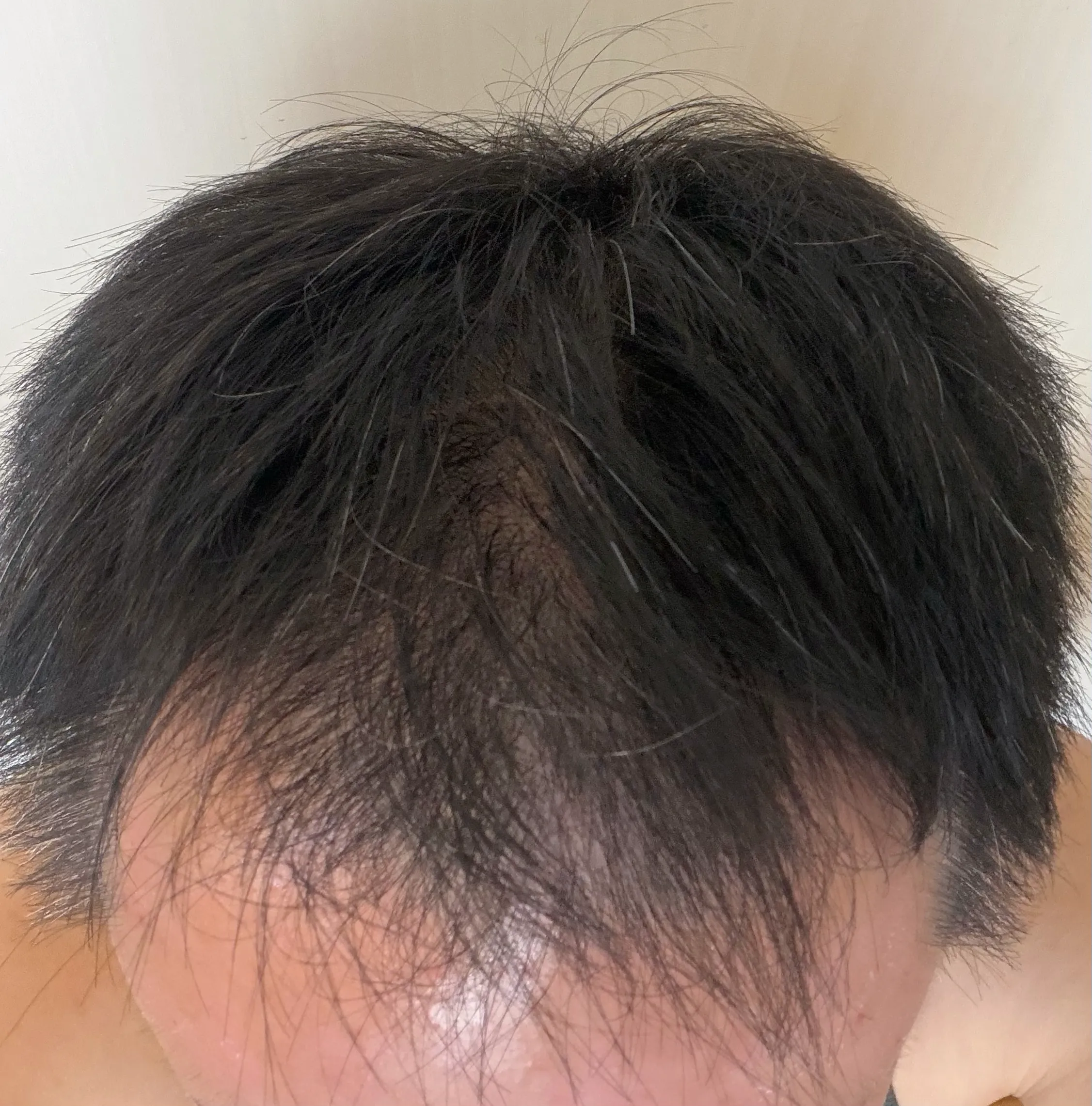 2026年9月22日撮影、前方から見下ろした髪の写真